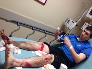 Brian Yoes, 25, of Grandview Hills is treated at the hospital on Dec. 28 after his right leg was run over by the teens who stole his car.